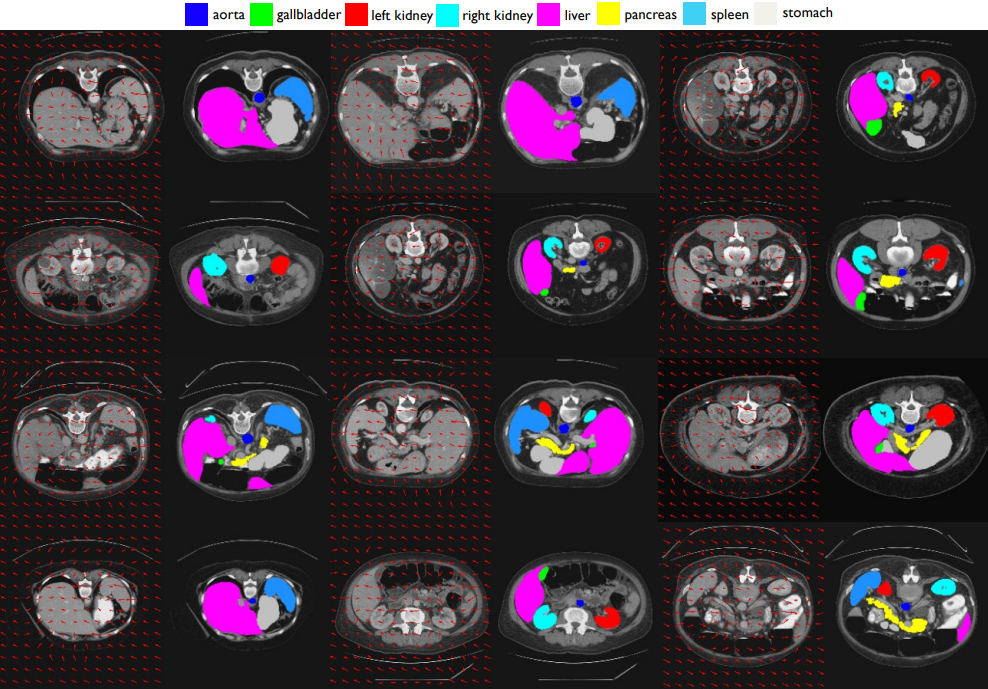 Visualization of sampled locations in the proposed class-aware transformer module