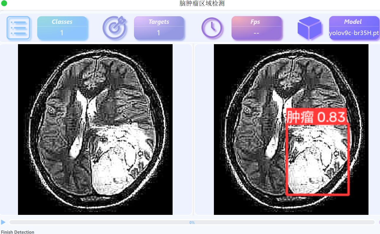  基于YOLOv9的脑肿瘤区域检测