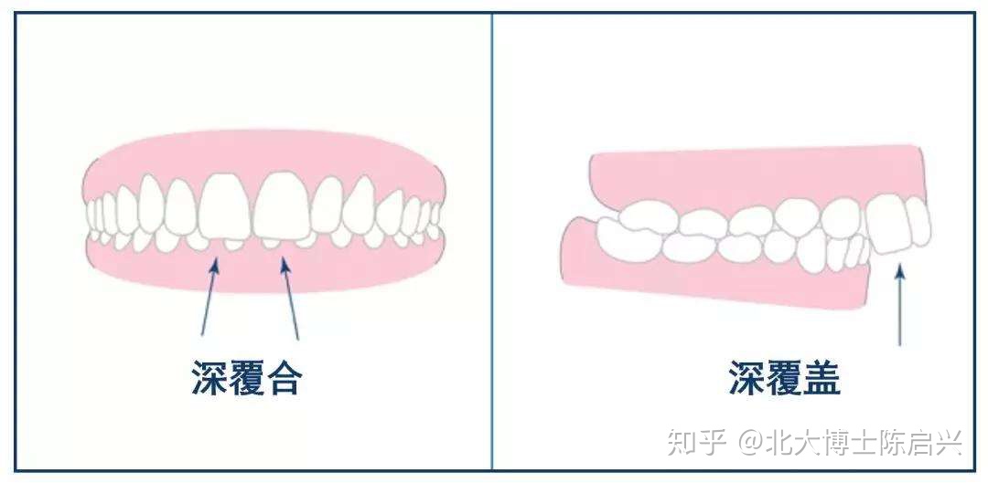 e0fffc15a53f856435bfadc64826af5d.png