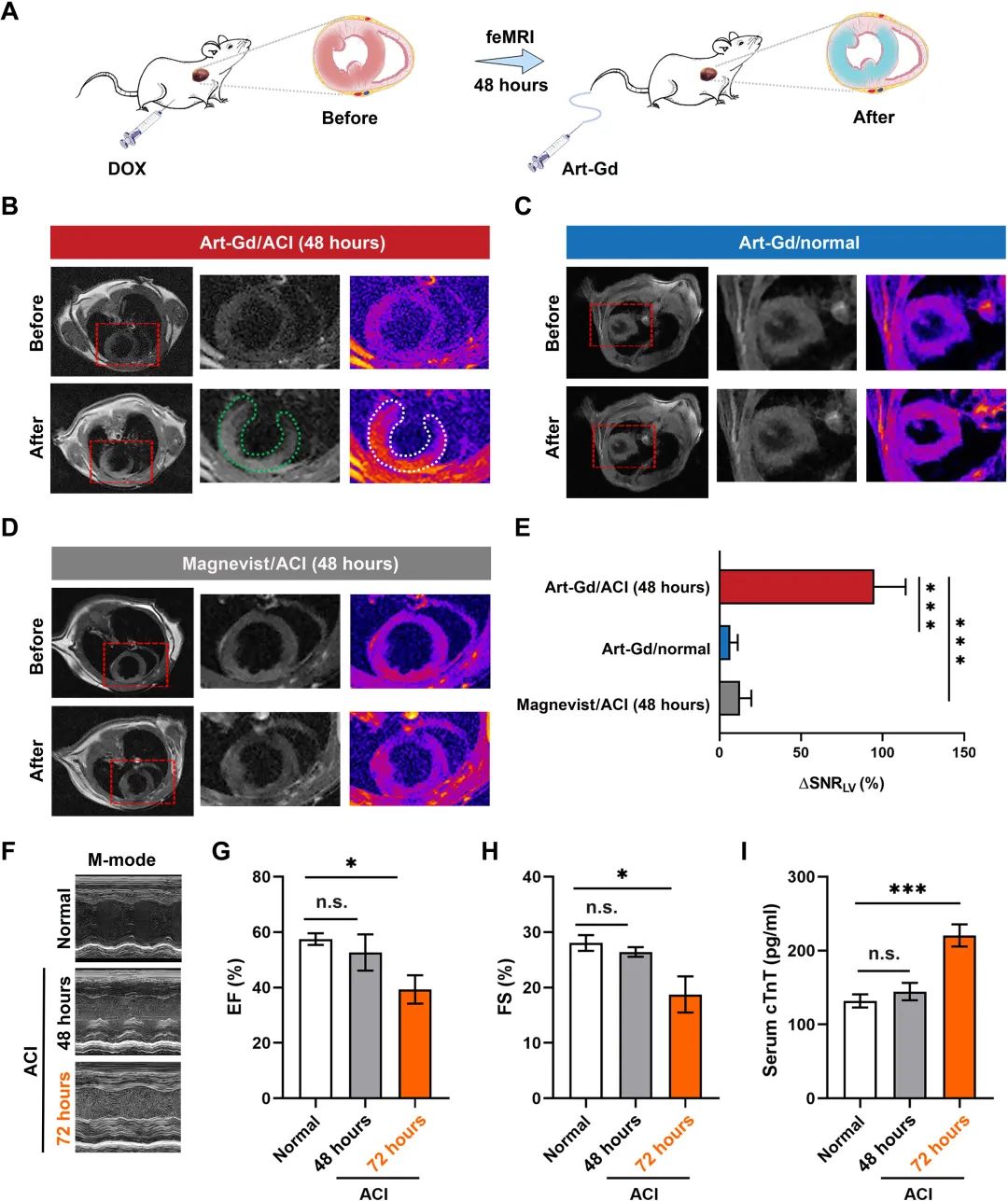 Science子刊：一个抗癌新策略终被发现！_ferroptosis mri for early detection of ...