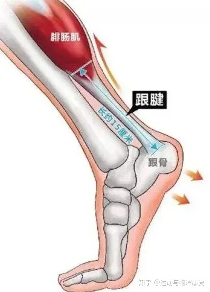 怎么判断到了月初如何判断是不是跟腱断了跟腱断了能治好吗
