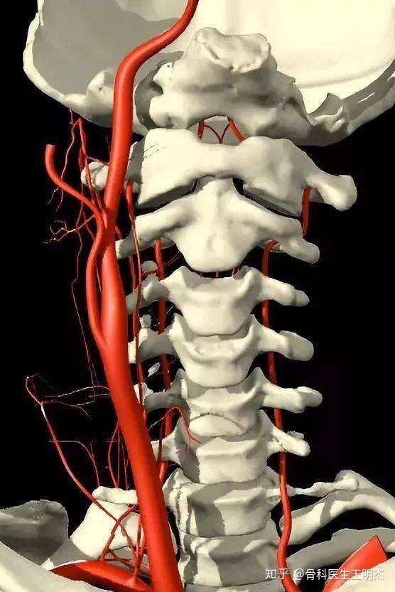 椎動脈型頸椎病患者,因病變直接累及推動脈,使椎—基底動脈系統供血不