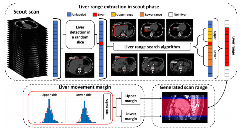 自动扫描范围在减少剂量多相CT肝脏成像中的应用：基于CNN和高斯模型| 文献速递-深度学习自动化疾病检查