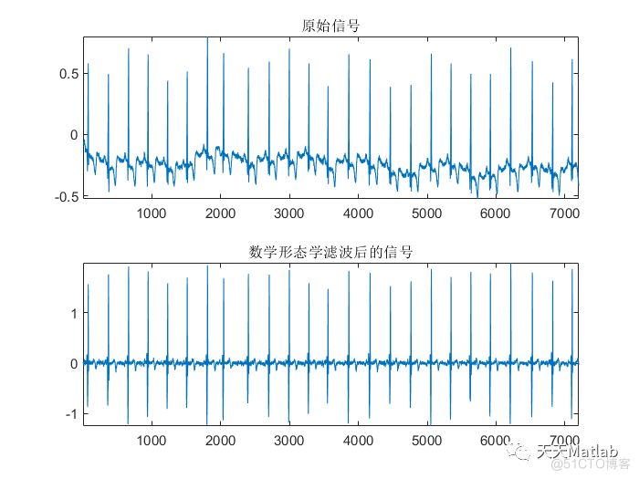 【心电检测】基于数学形态学实现心电信号R波检测附matlab代码_预处理_02