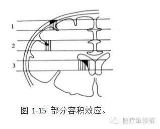 【转】CT基本概念（必须掌握）!!!!!!!!!!!!!!