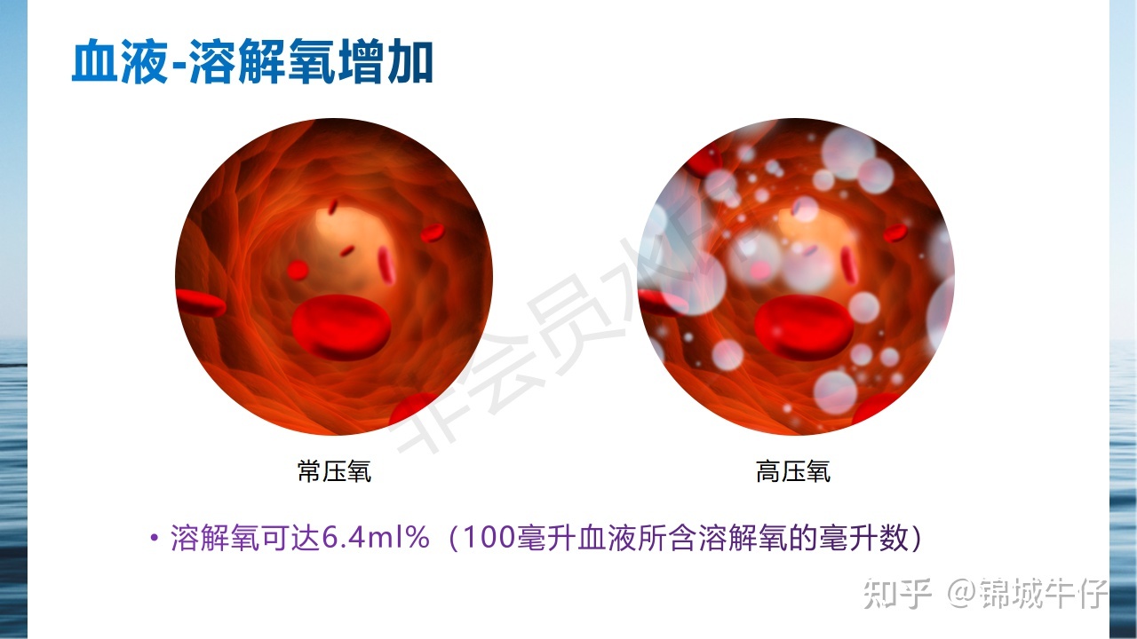 高压氧治疗主要机理