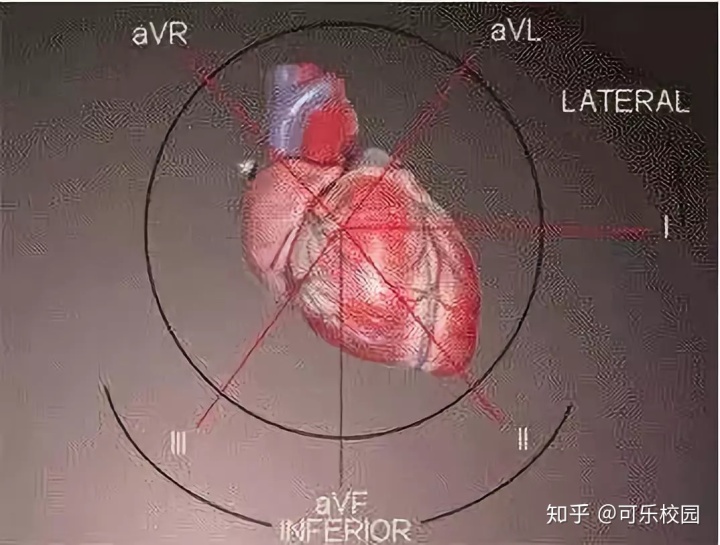 心电电轴图片