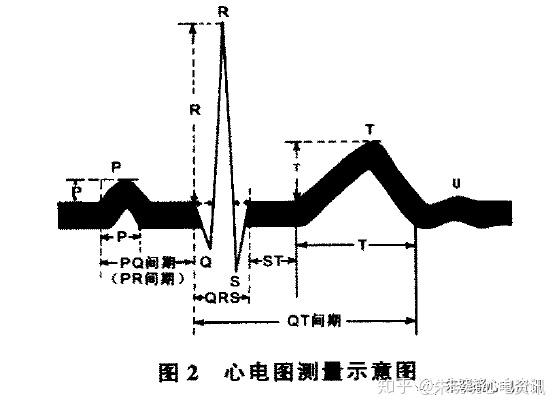 心電圖心電軸怎麼計算心電圖解讀講座系列第2講心電圖各波及如何閱讀