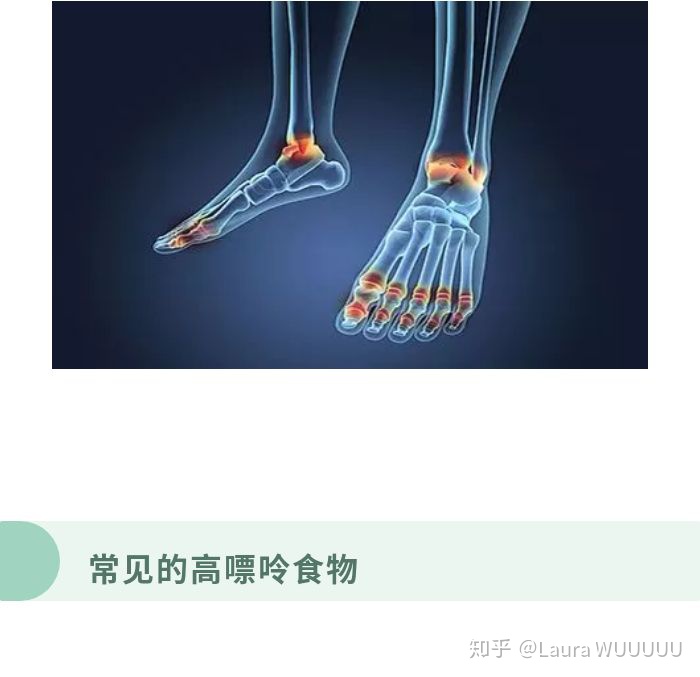 高嘌呤食物搜索引擎_嘌呤是什么,哪些食物嘌呤较高?