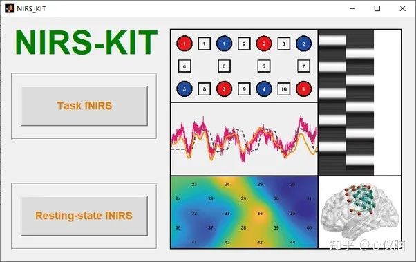 我的fNIRS学习之路第“零”期 — fNIRS学习资料汇总