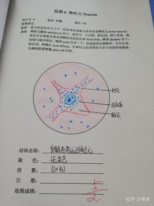 多极神经元手绘图作业_神经细胞手绘图