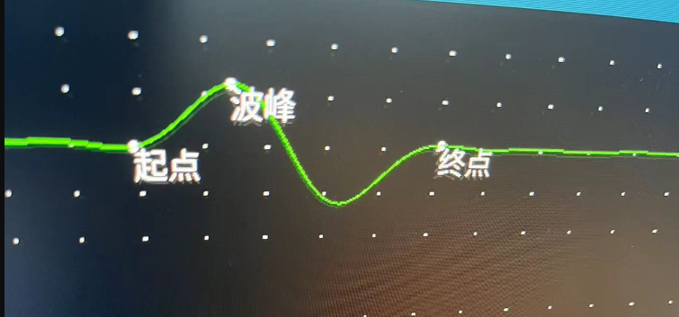 一种基于肌电信号运动起点、波峰、终点实时自动检测的方法