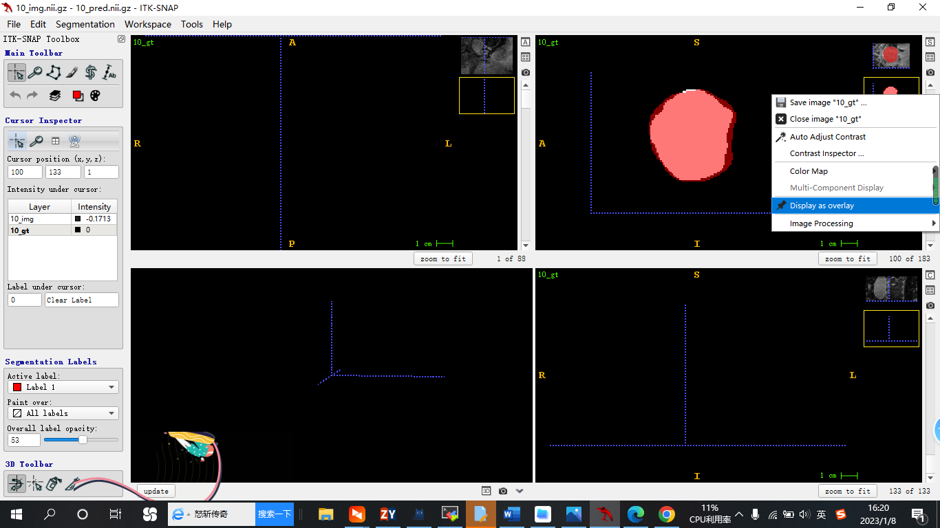 ITKSNAP基础教程_itk snapCSDN博客