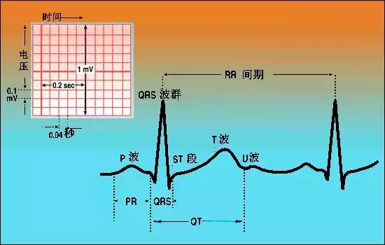 心電圖心電軸怎麼計算心電圖基礎知識詳解